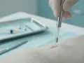 Zabieg kastracji chemicznej psa. Weterynarz w rękawiczce wprowadza implant pod skórę zwierzęcia.