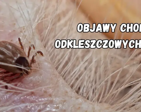 Zbliżenie na kleszcza psiego wgryzionego w skórę psa. Tekst informuje o objawach chorób odkleszczowych u psów.